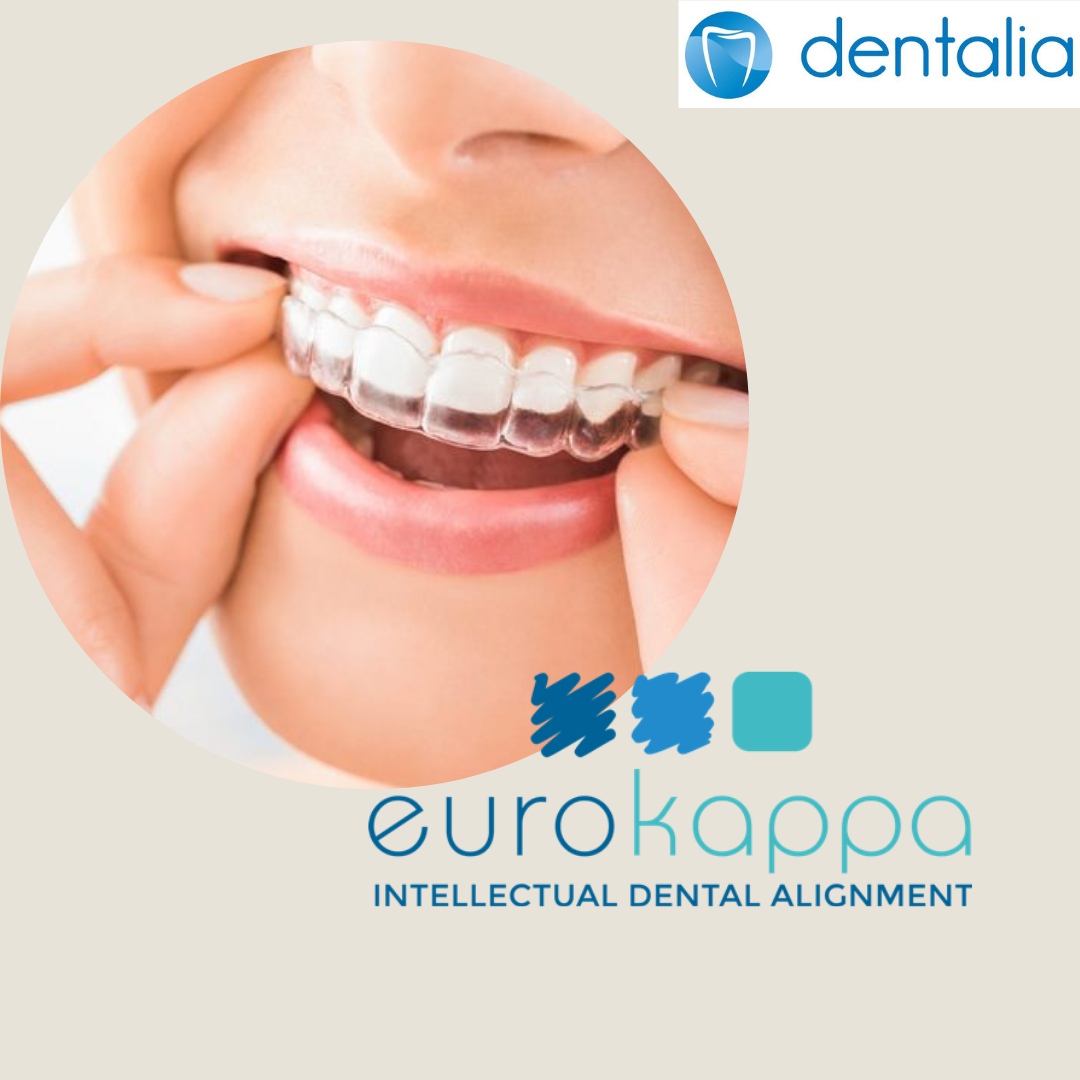 элайнеры eurokappa. еврокапа для зубов. Eurokappa. Eurokappa для зубов. элайнеров еврокаппа.