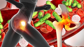 CURE CHRONIC ARTHRITIS Repair All Nerves and Veins Of The Body,Clear Bad Energies- Foot Massages #.