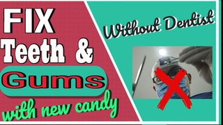 Bleeding Gums Home Remedies & Treat Your Bleeding Gums At Home