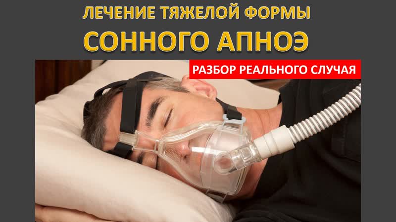 29: Лечение тяжелой формы сонного апноэ с помощью СИПАП