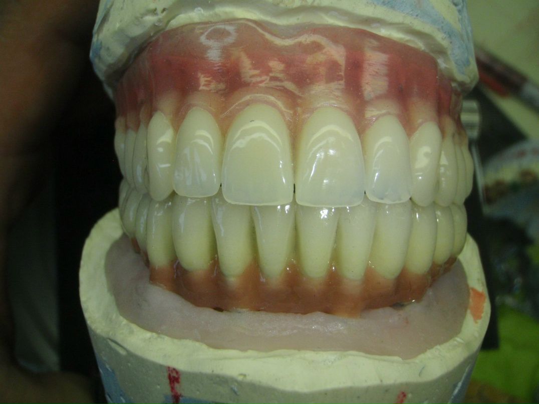 Эрнест Абрамян | Москва