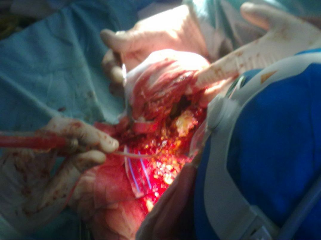 Эльгюн Мамедов | Москва