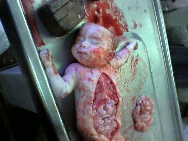 Онотоле Негодуе | Москва