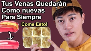 Elimina Grasas en tus Venas PARA SIEMPRE | 2 Remedios Caseros Que Te darn Venas Sanas como Nuevas