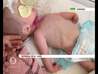 Як змінилися умови утримання однорічної сироти Світланки