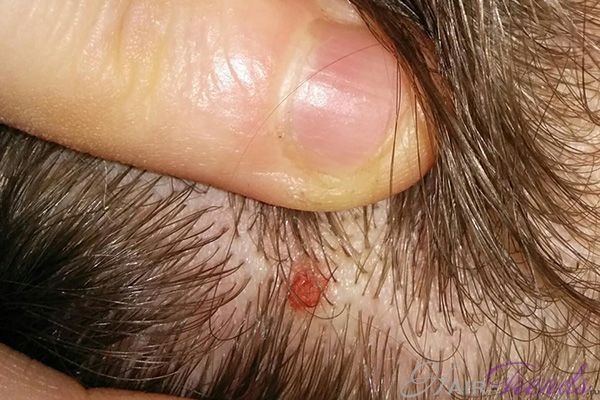 У меня на ногах много таких